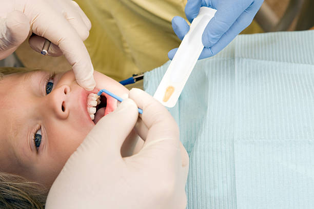 Fluoridebehandeling ter preventie van gaatjes bij Zonnelach Rotterdam
